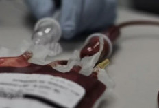 Penyakit Langka Anemia Aplastik dan Tanda-Tandanya