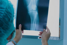 Kenali Perbedaan Tumor Jinak Tulang dan Kanker Tulang: Gejala, Penyebab, dan Penanganannya
