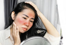 5 Ciri Wajah Terkena Merkuri dan Cara Mengatasinya Secara Aman