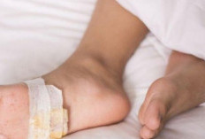 Luka Diabetes yang Sulit Sembuh: Penyebab dan Cara Menghindarinya