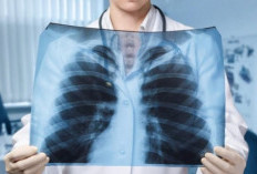 7 Cara Alami dan Medis Membersihkan Paru-Paru Agar Tetap Sehat