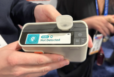Allergen Alert Unjuk Gigi di CES 2026 Mini Lab Portabel yang Bikin Makan Jadi Lebih Aman