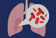 Jauhi Pneumonia Dengan Gaya Hidup Sehat untuk Paru-Paru Kuat
