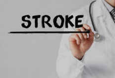 Fakta dan Mitos Seputar Penyakit Stroke yang Perlu Kamu Ketahui