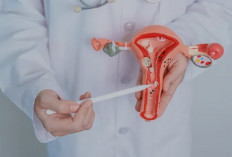 Benjolan Jinak di Rahim? Kenali Fibroid dan Cara Mengendalikannya