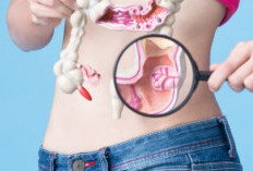 Anemia Bisa Jadi Sinyal Awal Kanker Usus Besar, Waspadai Gejalanya!