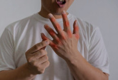 Komplikasi Berbahaya Akibat Asam Urat yang Tak Segera Diatasi