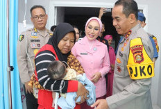 Prihatin Bayi Perempuan Lahir Tanpa Tempurung Kepala