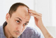 5 Rahasia Alami Menumbuhkan Rambut Terbebas dari Kebotakan