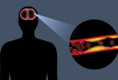 Bisakah Stroke Disembuhkan Total? Ini Faktanya