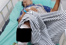 Petani Karet Diduga Diserang Beruang, Alami Luka Serius