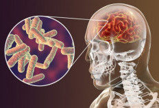 Waspada! Gejala Meningitis Tuberkulosis yang Tak Boleh Diabaikan