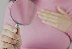 Jangan Abaikan! Begini Cara Membedakan Benjolan Tumor dan Kanker di Payudara