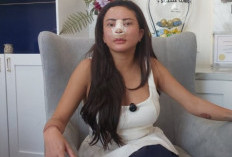 Demi Peran Film Horor, Ayu Aulia Rela Oplas Hidung ke-8 Kalinya