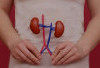 Waspadai TBC Ginjal: Infeksi Senyap yang Bisa Merusak Organ Vital