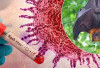 Dinkes OKI Keluarkan Imbauan Waspada Virus Nipah