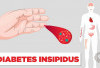 Mengenal Penyebab Diabetes Insipidus dan Jenis-Jenisnya